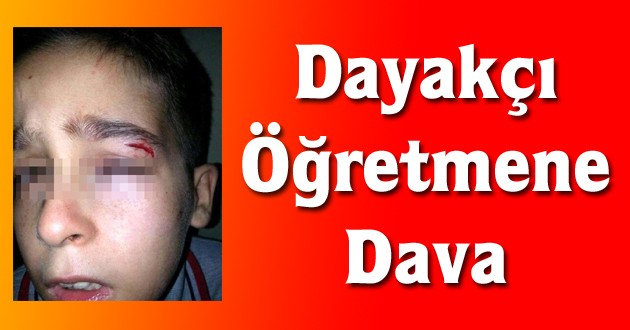 Kitapla Vurup Öğrencisini Yaralayan Öğretmene Dava